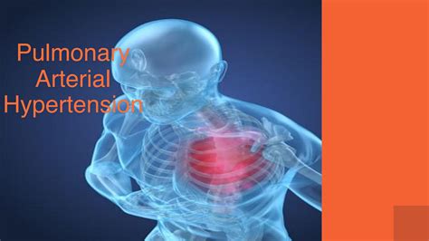 Pulmonary Arterial Hypertension Pah By Drmaishaggarwal Issuu