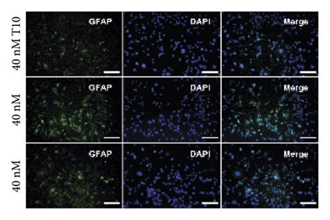 T Regulated Microglia Polarization Through The Ccl Ccr Axis And