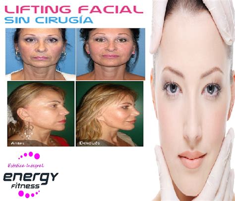 Estetica Integral Rejuvenecimiento Facial