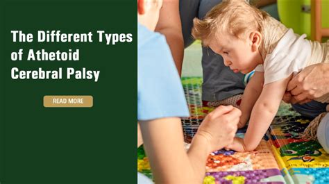 The Different Types Of Athetoid Cerebral Palsy