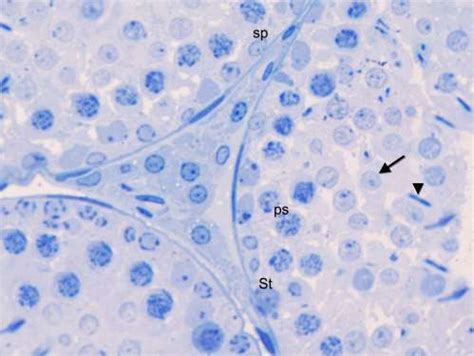 A Semithin Section Of The Testis Of An Adult Rat Of The Diabetic