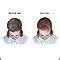 Female Pattern Baldness MedlinePlus Medical Encyclopedia