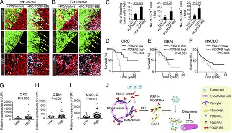 PDGF BBstimulated Pericytes Promote Primary Cancer Invasiveness A