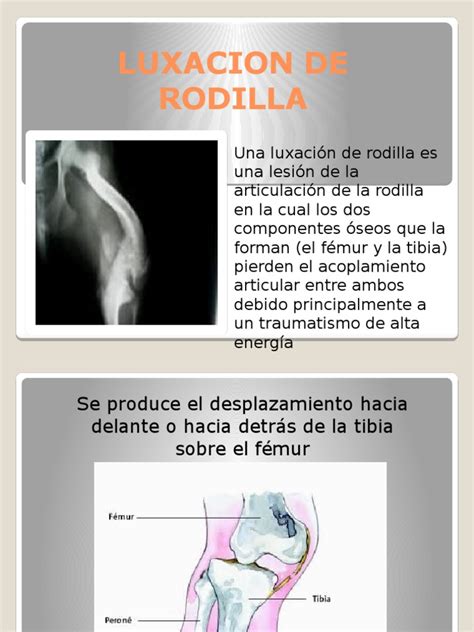 Pdf Luxacion De Rodilla Dokumen Tips