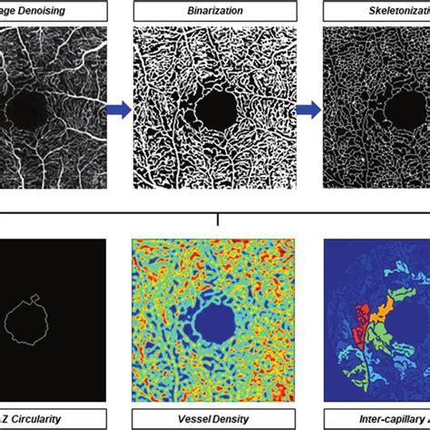 Quantification Of Retinal Microvasculature From Oct Angiography Octa Download Scientific