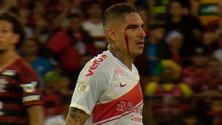 Paolo Guerrero Termin Sangrando Fue Expulsado Del Partido Entre