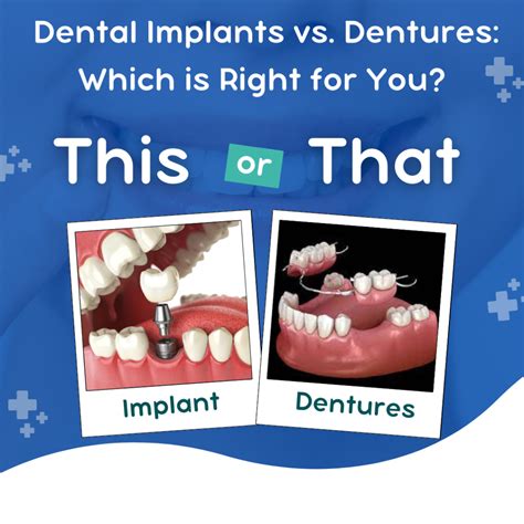 Dental Implants Vs Dentures Which Is Right For You