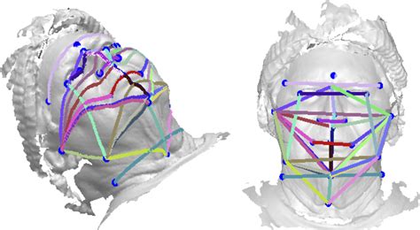 Study Suggests 3 D Face Photos Could Be A Sleep Apnea Screening Tool