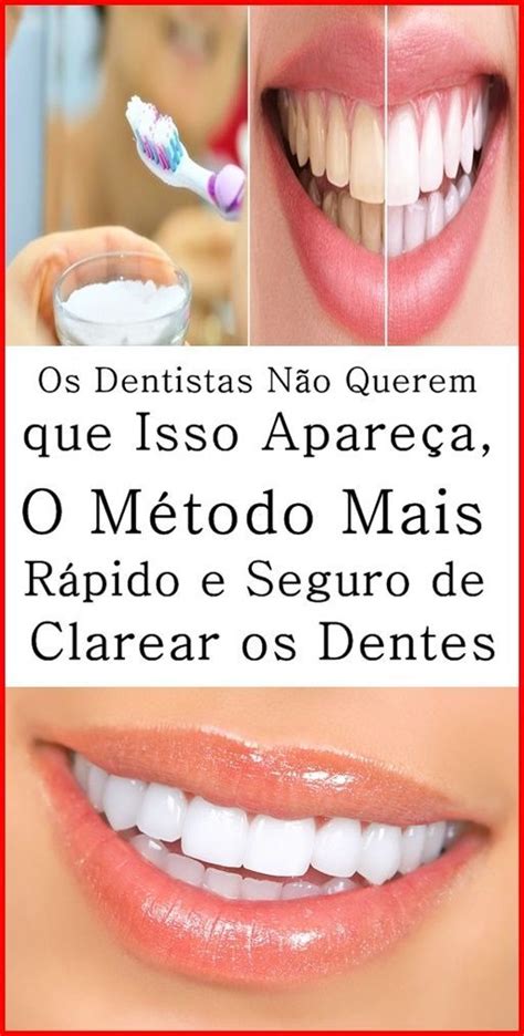 Os dentistas não querem que isso apareça O método mais rápido e seguro