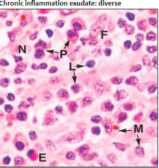 Histology Exam 2 Lecture 10 Inflammation And Wound Healing