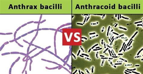 Anthrax Bacilli Vs Anthracoid Bacilli 25 Differences