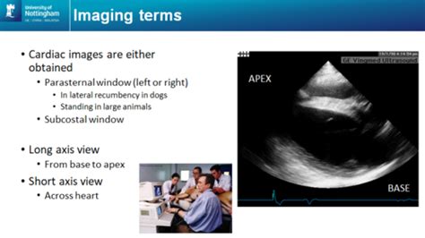 Cardiorespiratory Ultrasound Flashcards Quizlet