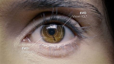 Lentes Intraoculares F Cicas Cl Nica De Olhos