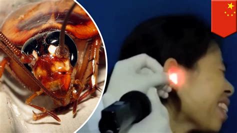 Cockroach In Ear Video Of Chinese Woman Have Having Live Insect Pulled