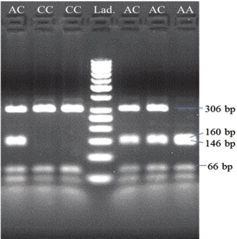 Electrophoregram With Restriction Fragments Of Amplified PCR Products