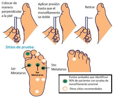 Examen físico del pie diabético Diabetes