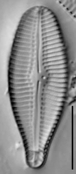 Compare Gomphoneis Septa Species Diatoms Of North America