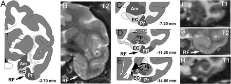 Location Of Entorhinal Cortex Ec In Rhesus Monkey With The