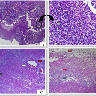 Histological Sections Of The Colonic Resection Piece A HE Stained