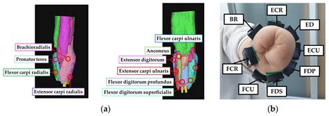 Sensors Free Full Text Semg Based Hand Posture Recognition And