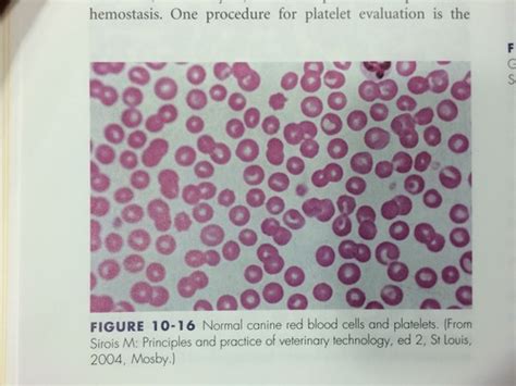 Clin Path Ii Blood Film Flashcards Quizlet