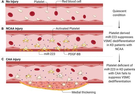 Kawasaki Disease Pathophysiology