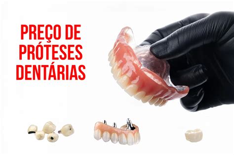 Curso De Prótese Dentária Valor - prótese dental | Ciotti Odontologia