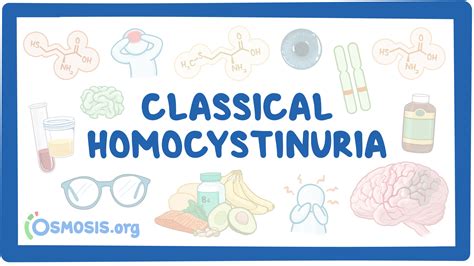 Classical Homocystinuria Nord Video Causes Meaning Osmosis