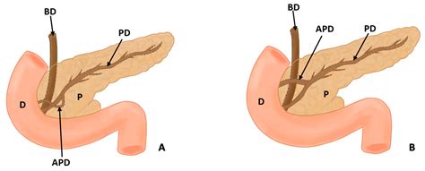 Life Free Full Text Incidence And Clinical Implications Of Anatomical Variations In The