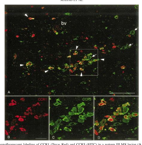 Figure 5 From Expression Of Chemokine Receptors Ccr1 And Ccr5 Reflects