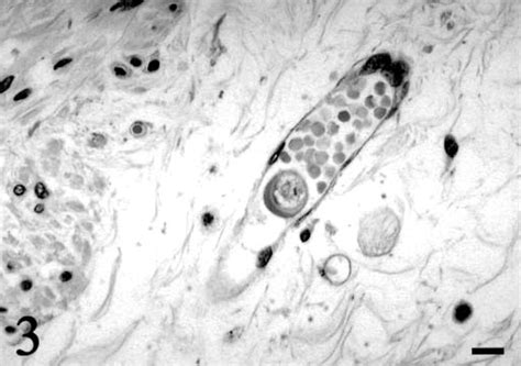 Entamoeba Histolytica Trophozoite