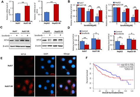 Silencing Kif14 Reverses Acquired Resistance To Sorafenib In