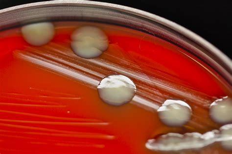 Images Microbiology Klebsiella Pneumoniae Clinical Chemistry