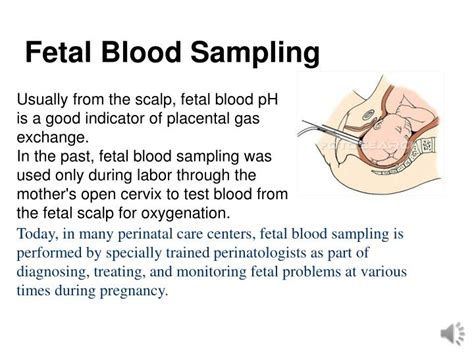 Ppt Fetal Monitoring Powerpoint Presentation Id1898600