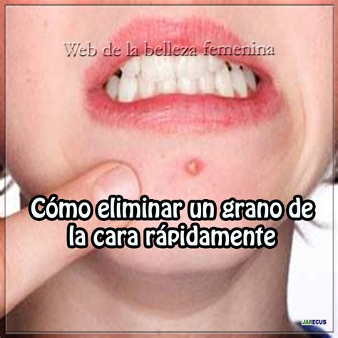 C Mo Eliminar Un Grano De La Cara R Pidamente Salud Y Belleza