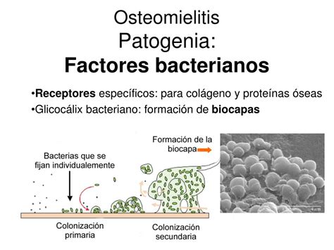 Ppt Diagnóstico Microbiológico De Las Infecciones Osteoarticulares