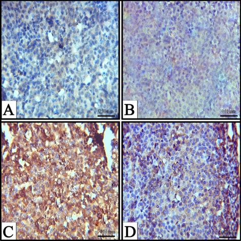 Photomicrographs Showing Immuno Histochemical Localization Caspase