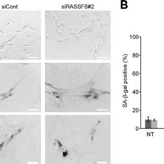 RASSF6 Knockdown Does Not Affect The Senescence Induced By H 2 O 2 And