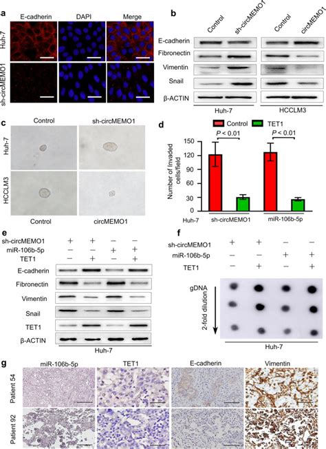 Circmemo1 Modulates The Promoter Methylation And Expression Of Tcf21 To