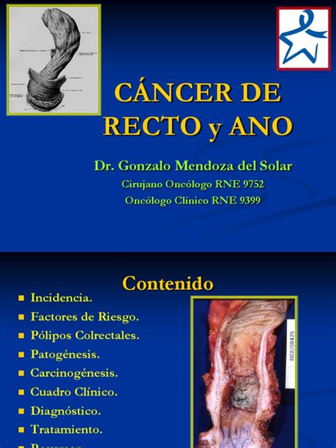 Cancer De Ano Y Recto