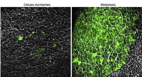 Descubren cómo las células tumorales pueden estar latentes durante años