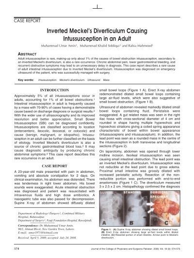 Inverted Meckels Diverticulum Causing Intussusception In An Adult