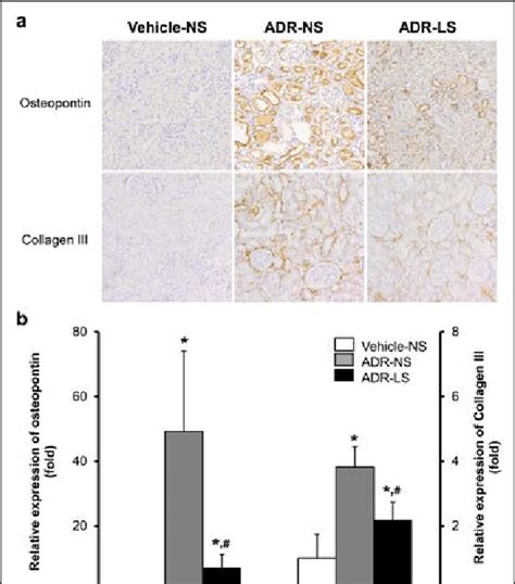 Immunohistochemical Analysis Of Osteopontin OPN And Collagen III