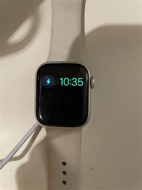 Series 7 Watch Won’t Charge I’ve Had It For A While And Had No Issues And It Was Completely