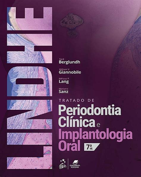 Tratado De Periodontia Clinica E Implantologia Oral Edi O