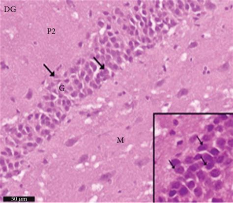Photomicrographs of the hippocampus of albino rat group V (PLC/L ... 