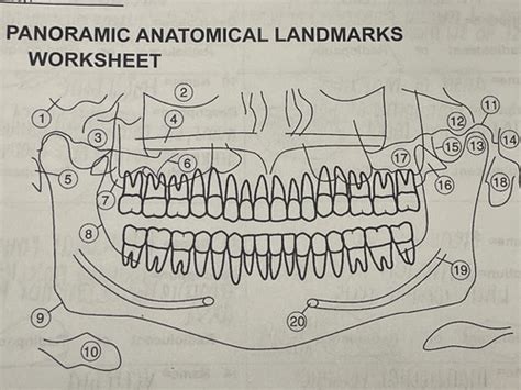 Panoramic Anatomical Landmarks Worksheet Flashcards Quizlet