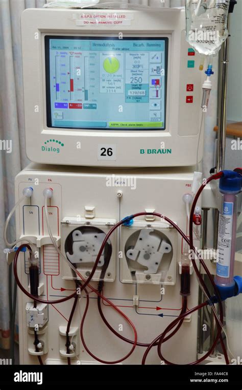 Dialysis machine in use on the Dialysis unit Stock Photo - Alamy