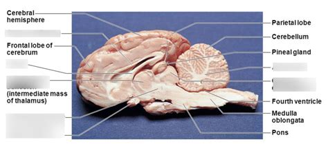 Sheep Brain Lobes Scienceforyou