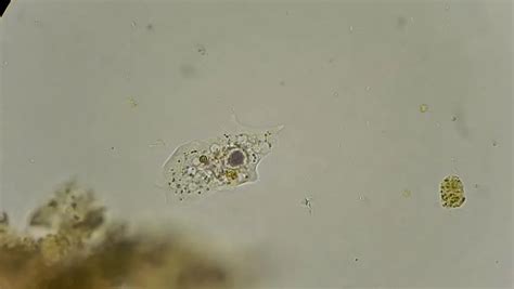 Amoeba Under Microscope 40x Amoeba Proteus Slide W M Despite The Presence Of An Opaque Shell